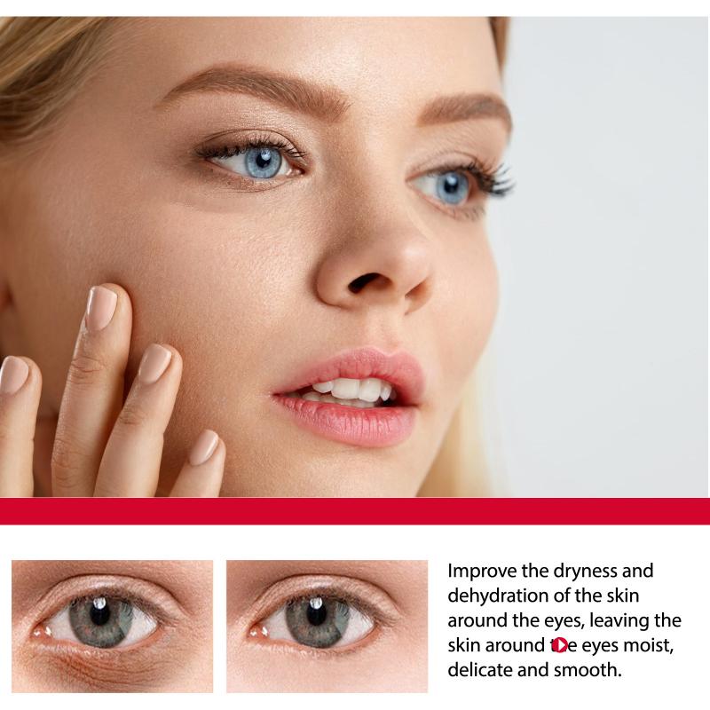 Women Bags Under Eyes - ครีมบำรุงรอบดวงตาเรตินอล ลดเลือนริ้วรอย ถุงใต้ตา และรอยคล้ำ ช่วยเติมความชุ่มชื้น ยกกระชับ