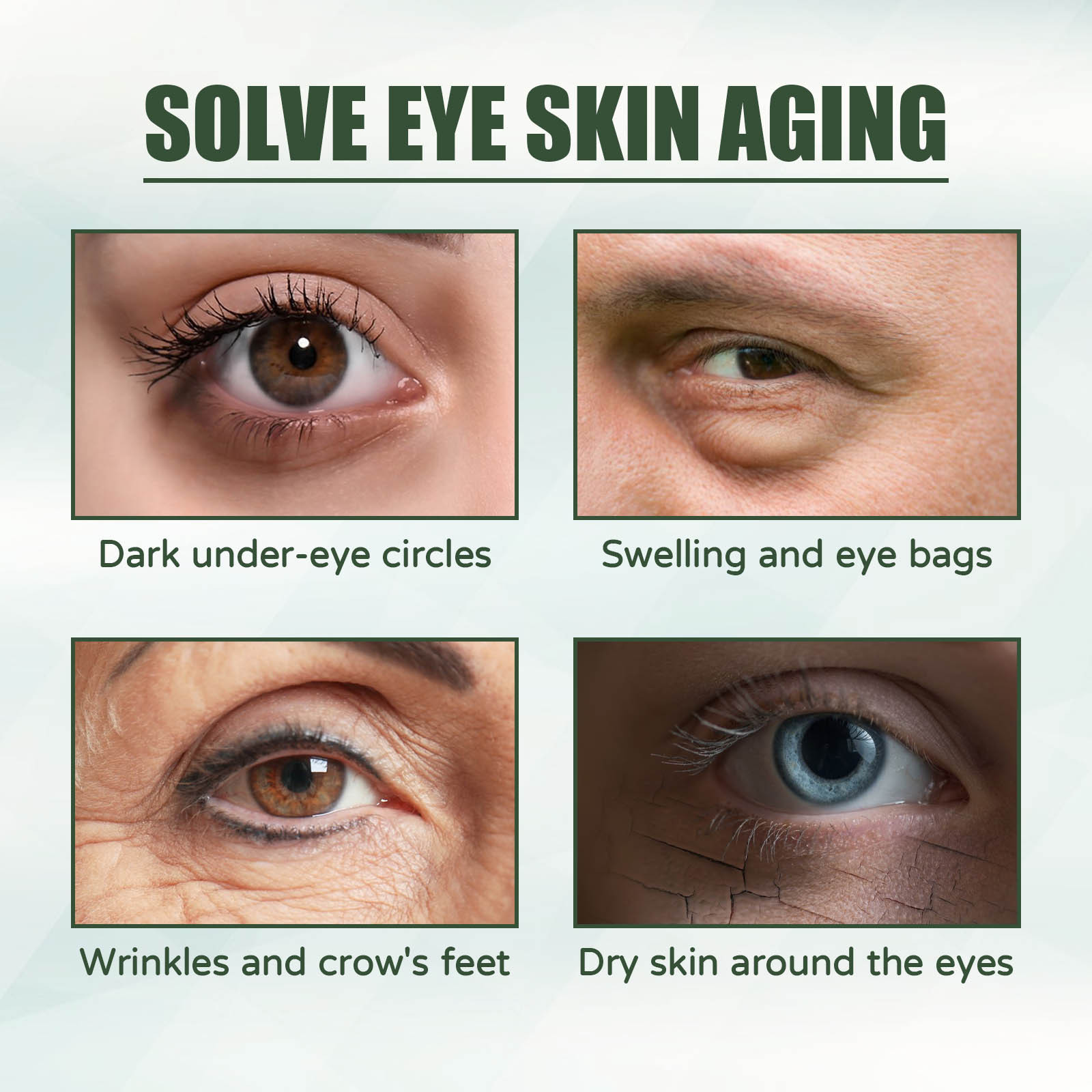 Eelhoe ครีมทาใต้ตาต่อต้านริ้วร - Women Bags Under Eyes บทวิจารณ์และราคา