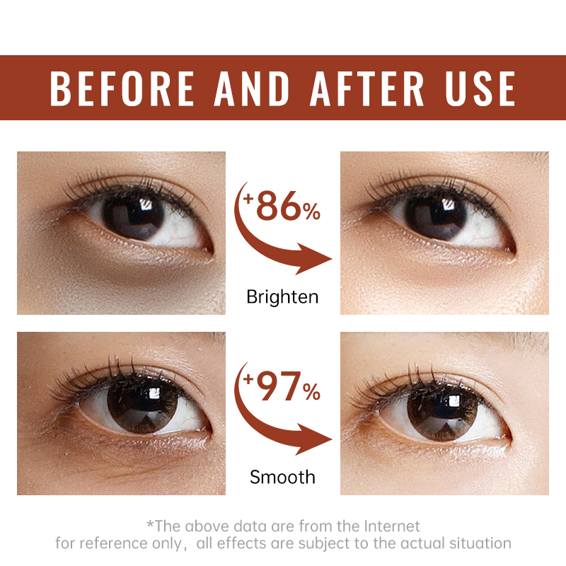 เรตินอล เฟิร์มมิ่ง อาย ครีม แอ - Women Bags Under Eyes บทวิจารณ์และราคา
